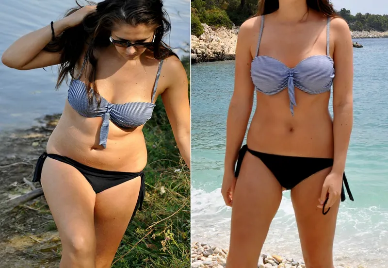 Emily, 35 before and after